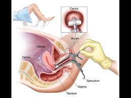 Pap Smear Youtube