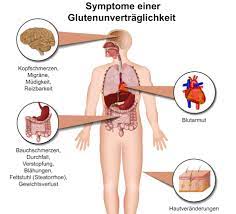 Die behandlung der erkrankung erfolgt in erster linie durch die lebenslange einhaltung der glutenfreien ernährung. Mooci Zoliakie Finger Weg Von Gluten