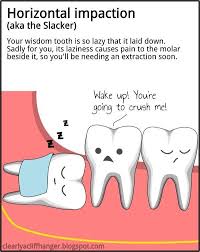 Horizontal Impact Ion Wisdom Teeth Children S Dental Health Center Pediatric Dentist In Stoughton Ma Childrensdental Wisdom Teeth Teeth Humor Dental Fun