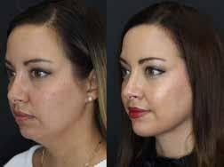 Mckayla Abbott's Instagram, Twitter & Facebook