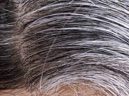 Hair going white overnight q: White Hair Causes And Ways To Prevent It