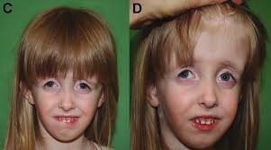 Table of Contents, Volume 155, Number 4, April 2011