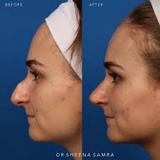 🙏🏼Beyond blessed to have been welcomed with open arms and hearts by Dr. Keith  Marcus, his amazing team, and the South Bay community. Thank you all for an  incredible year ❤️ @drkeithmarcus @