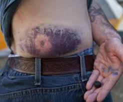 Close-up of a Sublethal Projectile