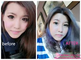 敲鼻骨+耳軟骨墊鼻頭+三段式隆鼻】星采整形外科診所/大安醫美-邱大睿醫師-終於有高挺山根整形心得全紀錄_Demi