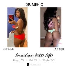 111 reviews of mia aesthetics miami they were wonderful. Mia Aesthetics Dr Mehio Booty Alert Drmehio Mia Facebook