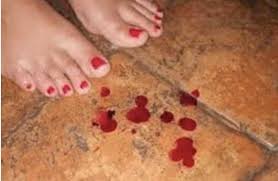 Pictures of spotting during pregnancy. How Much Bleeding During Pregnancy Is Normal