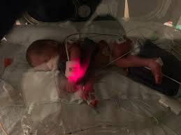 Just wanted to introduce myself. On 11/01/24 at only 27 weeks 5 days my  water broke at 2am. Went to the hospital to get checked out. Had an  ultrasound and it looked