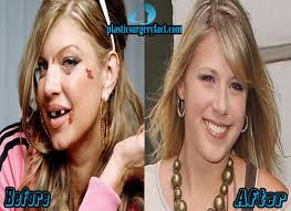 The california base celebrity is likely to have gone, along with breast augmentation, for some other cosmetic procedures to better her looks. Jodie Sweetin Plastic Surgery Before And After Plastic Surgery Facts