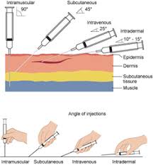 Image result for Intramuscular Injection