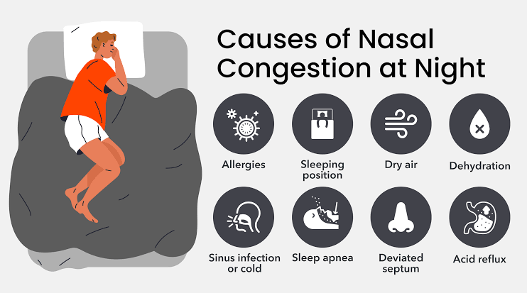 Key drivers of elevated nasal resistance during sleep, AI generated