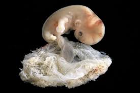 Pin On Placenta Art