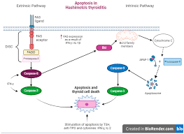 Image result for Thyroiditis