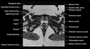 Related online courses on physioplus. Mri Female Pelvis Anatomy Axial Image 26 Pelvis Anatomy Pelvis Anatomy