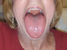 Image result for Isoglossa namuliensis