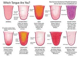 Which Tongue Are You Nine Common Syndromes And Possible