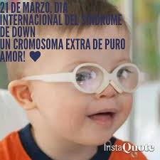Para celebrar el día mundial del síndrome de down en 2018, que se celebra el 21 de marzo, down españa lanza '#auténticos', su nueva campaña para aumentar la. 32 Sindrome De Down Ideas Down Syndrome Down Syndrome Kids Down Syndrome Baby