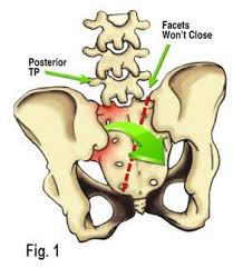 Pin On Physical Therapy