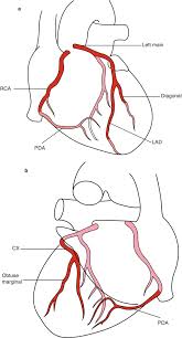 Termination of left anterior descending. The Coronary Artery Springerlink