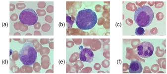 Maturity Stages Of White Blood Cells A Myeloblast B