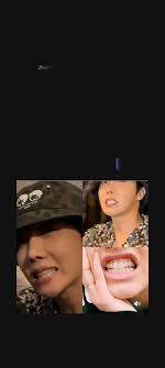 Jhope Teeth Before and After