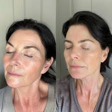 Experience the Benefits of Red Light Therapy with Kala Therapy