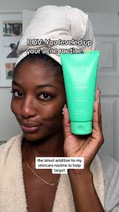 Skinfix Acne Skincare Routine for Clear Skin