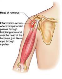 The muscles and tendons of the rotator cuff form a sleeve around the anterior, superior, and posterior humeral head and glenoid cavity of the shoulder by compressing the glenohumeral joint. Biceps Tendinopathy Physio Works