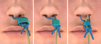 🎶 “you'll love david's bridle” : r/nursing