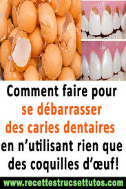 Pin On Parterres