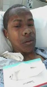 Teacher 'froze in shock' as she botched $5 flame experiment that burned  Georgia teen's face and body