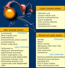 The Radiology Assistant Ovarian Cysts Diagnostic Work