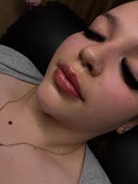 Any recommendation where to get lip filler ? And prices ?