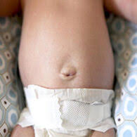 Avoid giving tub baths until after the stump falls off. Newborn S Umbilical Cord Belly Button Ask Dr Sears