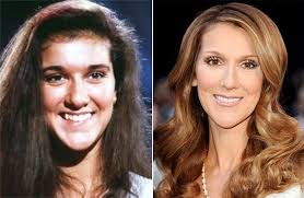 Plastic Surgeon Utah Salt Lake City Cosmetic Surgery Utah Celebrity Plastic Surgery Plastic Surgery Gone Wrong Plastic Surgery
