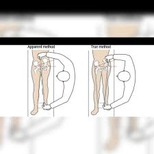 Image result for True Leg Length Discrepancy