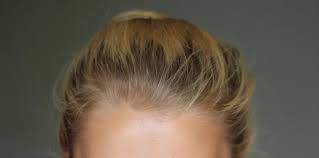 I now have golden blonde hair. Colour B4 Haarfarbenentferner Auch Auf Blonde Haare Haarfarbe Blond