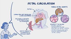 Image result for Delayed Transition from Fetal Circulation