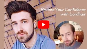 One of the best hair design, hair stylist, hair color, hairdresser near flushing, ny 11354. Great Discounts On Non Surgical Hair Replacement Systems