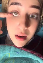 Rachel Eye Prosthetic