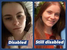 Non-Visible Disabilities