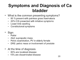 Because early signs are often ignored, women have a higher chance of being told they have an advanced stage of bladder cancer than men. Bladder Cancer Symptoms Of Bladder Cancer Kimaja Farwani