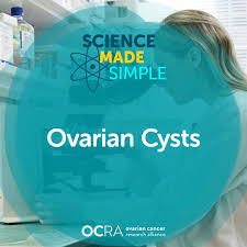 Ovarian cancer is one of those nightmare cancers: Difference Between Ovarian Cyst And Ovarian Cancer Ocra