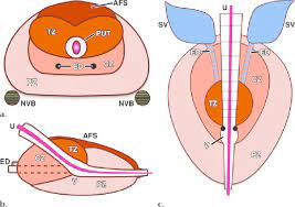 According to figures from the uk&#x27;s office for national statistics (ons), more men died of prostate cancer (11,819) than women died from breast cancer (11,442). Diagrams Show The Zonal Anatomy Of The Prostate In The Axial A Download Scientific Diagram