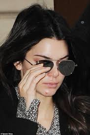 Kendall Jenner exhibits a pimple before Christian Dior's make-up artists  work their magic