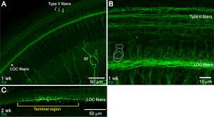Lower kindergarten me 3 se lekar 4 saal ke childern ko rakha jata hai jaha childern ko pencil pakadkar ke line khichna letter. Sound Exposure Dynamically Induces Dopamine Synthesis In Cholinergic Loc Efferents For Feedback To Auditory Nerve Fibers Elife