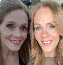 Best toxin free eye cream recommended