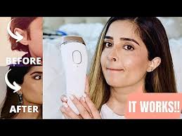 Ipl filters out any light in the uv range, so. At Home Laser Hair Removal 10 Month Update Did It Work Is It Worth It Youtube