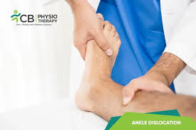 Image result for Ankle Dislocation