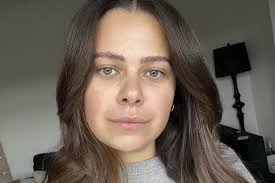 Hairdresser gruesomely impales hand